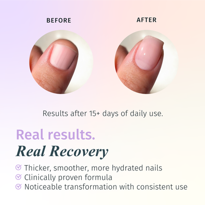 Rejuvacote 2 Nail Growth System, Super sensitive formula, Base and Top Coat, 12 Piece Display
