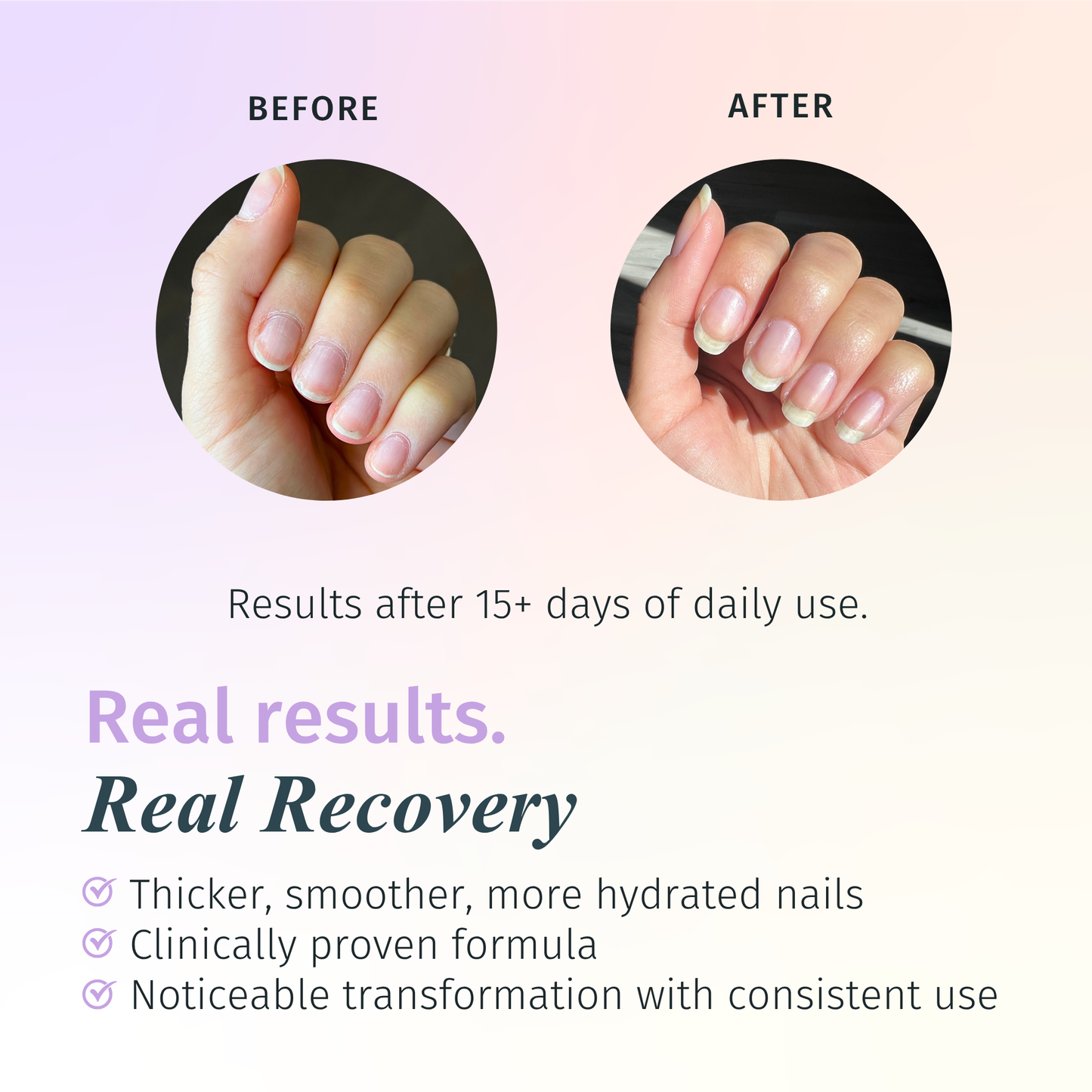 Rejuvacote 2 Nail Growth System, Super sensitive formula, Base and Top Coat, 12 Piece Display