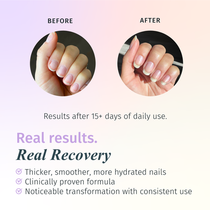 Rejuvacote 2 Nail Growth System, Super sensitive formula, Base and Top Coat, 12 Piece Display