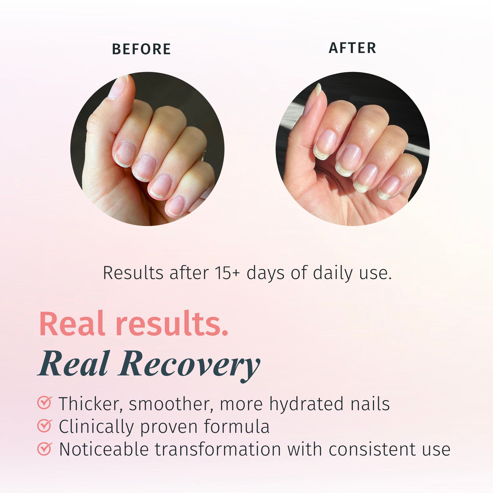 Nail Growth Treatment Polish Top and Base Coat - Rejuvacote 1 Original Maximum Strength Nail Growth System, Base and Top Coat - Duri Cosmetics - long lasting, sustainably made in small batches, made in USA