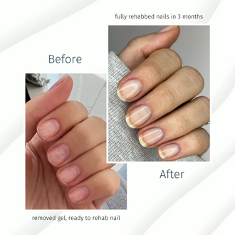 Rejuvacote 1 Original Maximum Strength Nail Growth System, Base and Top Coat